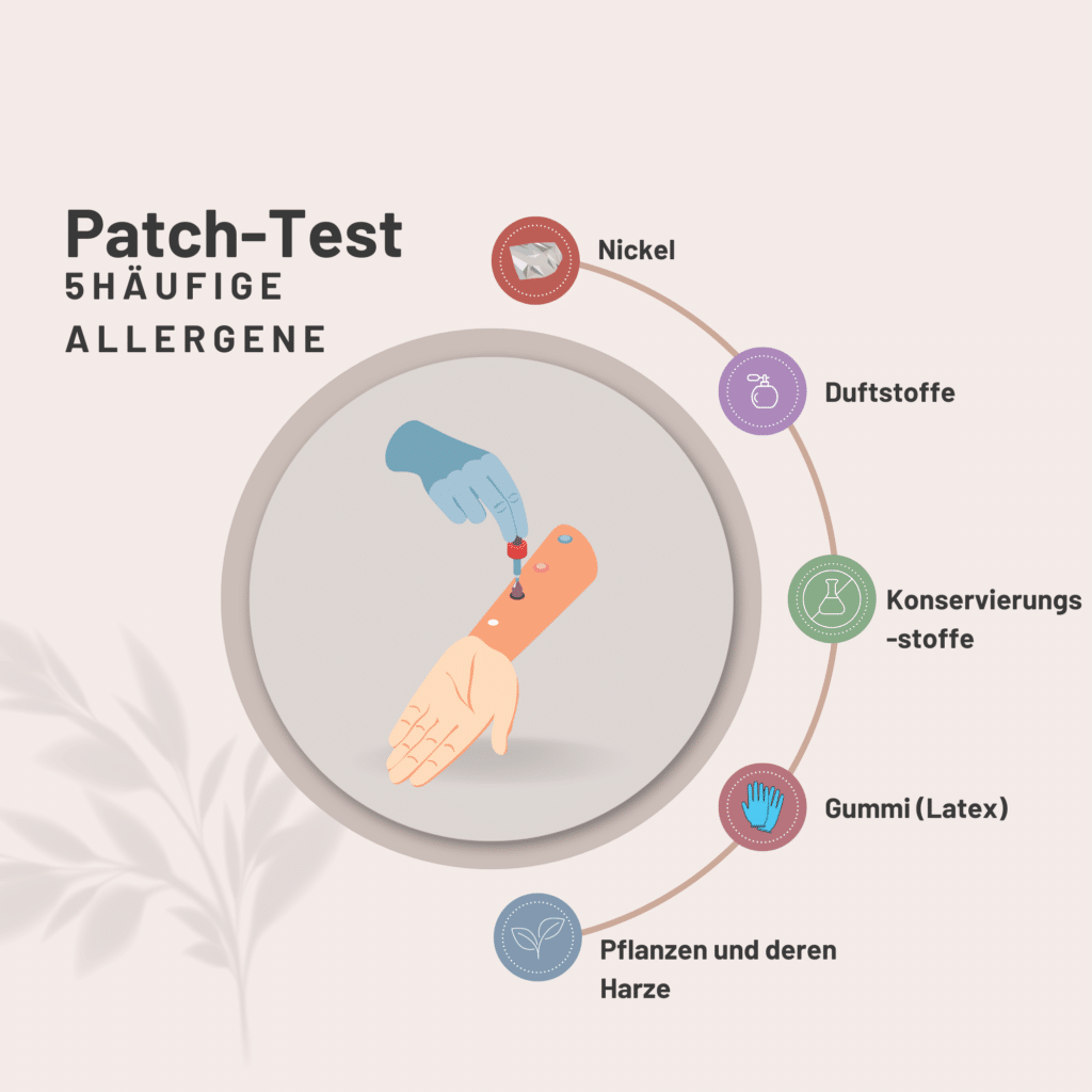 Patch-Test auf der Haut zur Diagnose von Kontaktallergien und die fünf häufigsten Allergene.