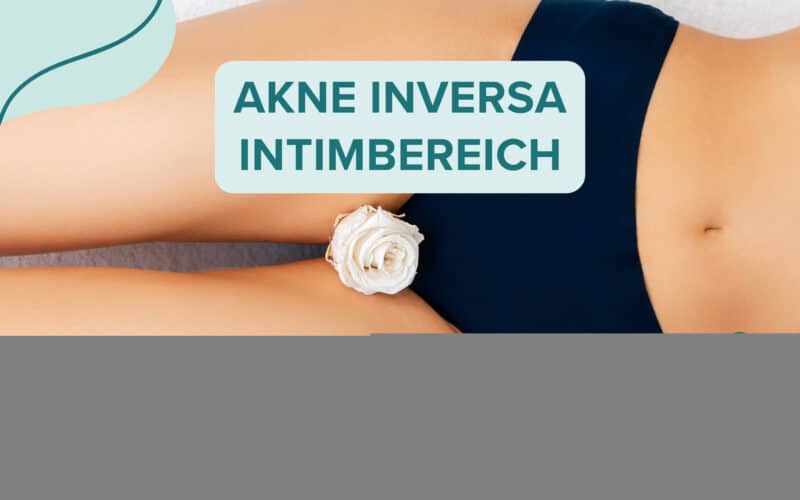 Frau in blauer Unterwäsche liegt mit einer weißen Rose auf dem Oberschenkel, Textfelder kennzeichnen 'Akne Inversa Intimbereich' sowie 'Symptome & Lösungen'.