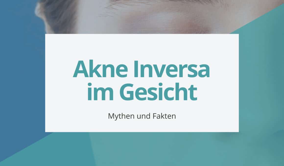 Akne Inversa im Gesicht