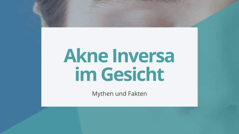 Akne Inversa im Gesicht