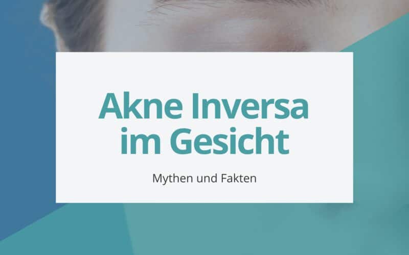 Akne Inversa im Gesicht