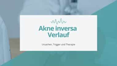 Akne inversa schubweise Verlauf Beitragsbild
