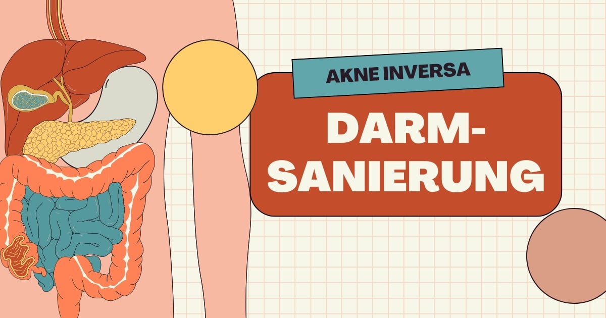 Illustration des Verdauungssystems mit Titel „Akne inversa Darmsanierung“ – Zusammenhang von Darmflora und Entzündung bei Akne inversa.